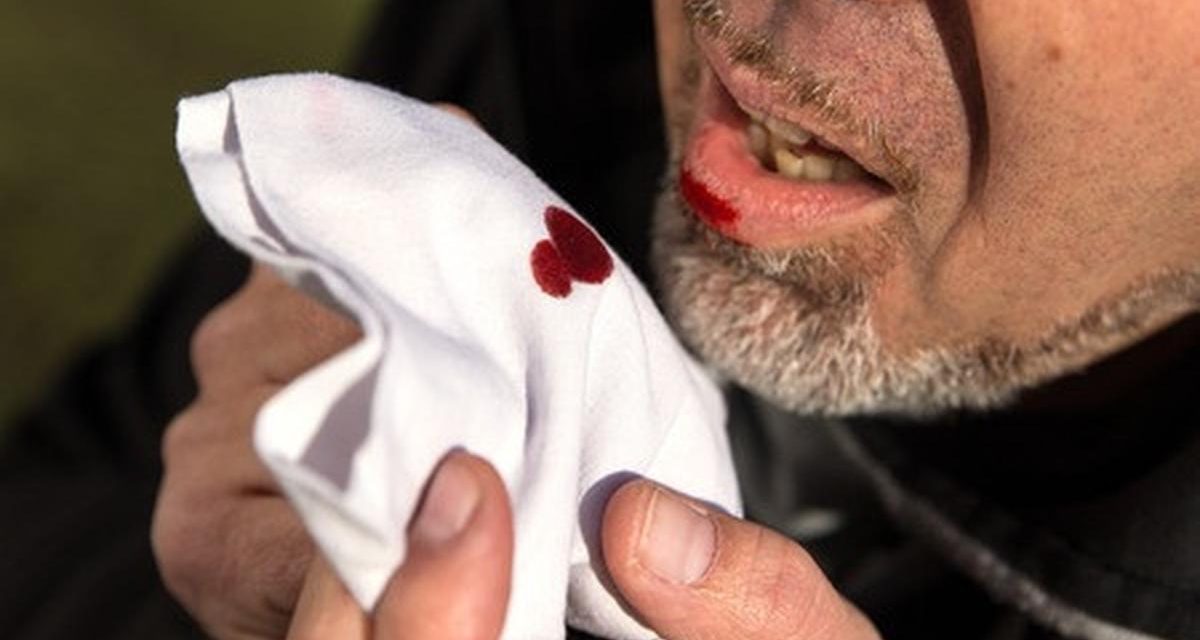 Faktor Risiko Batuk Berdarah Dari Infeksi Hingga Penyakit Kronis