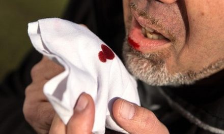 Faktor Risiko Batuk Berdarah Dari Infeksi Hingga Penyakit Kronis