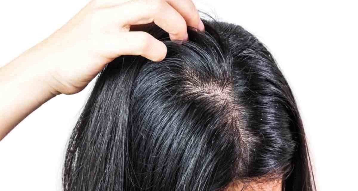 Penyebab Rambut Berminyak Dan Cara Mengatasinya