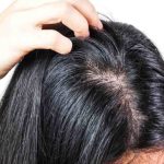 Penyebab Rambut Berminyak Dan Cara Mengatasinya