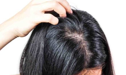 Penyebab Rambut Berminyak Dan Cara Mengatasinya