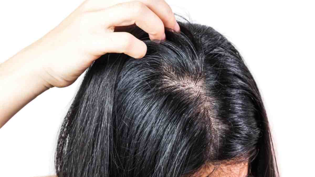 Penyebab Rambut Berminyak Dan Cara Mengatasinya